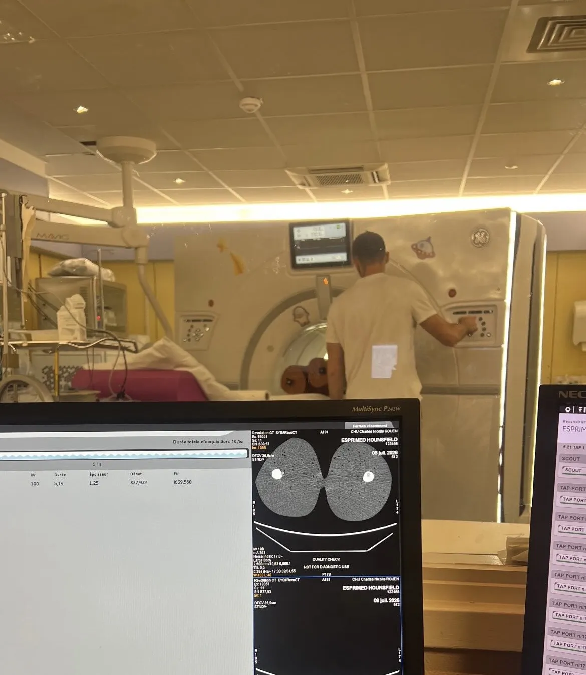 rex-esprimed-chaleur-au-travail